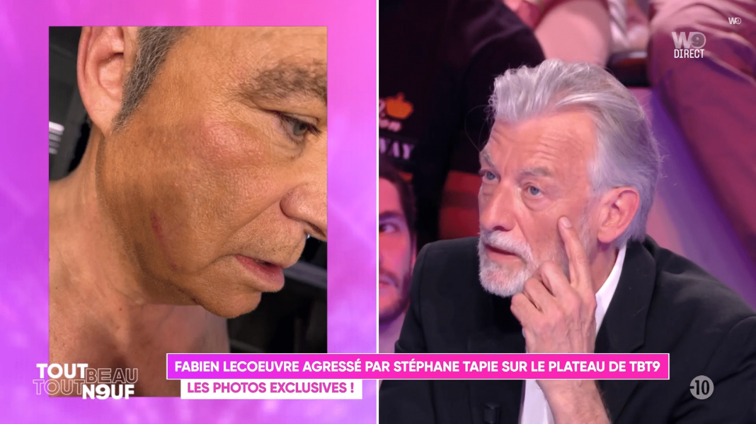 Fabien Lecoeuvre agressé par Stéphane Tapie : dans TBT9, les photos de ses blessures dévoilées