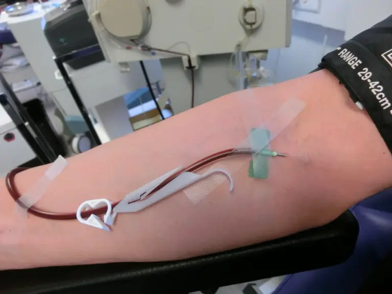 Bras d’un donneur relié au dispositif pendant un don de plasma