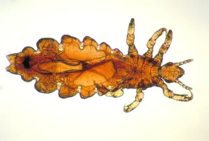 Pou de tête humain observé au microscope